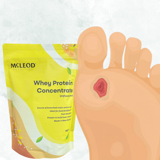 Whey Protein Supplementation & Pressure Ulcers